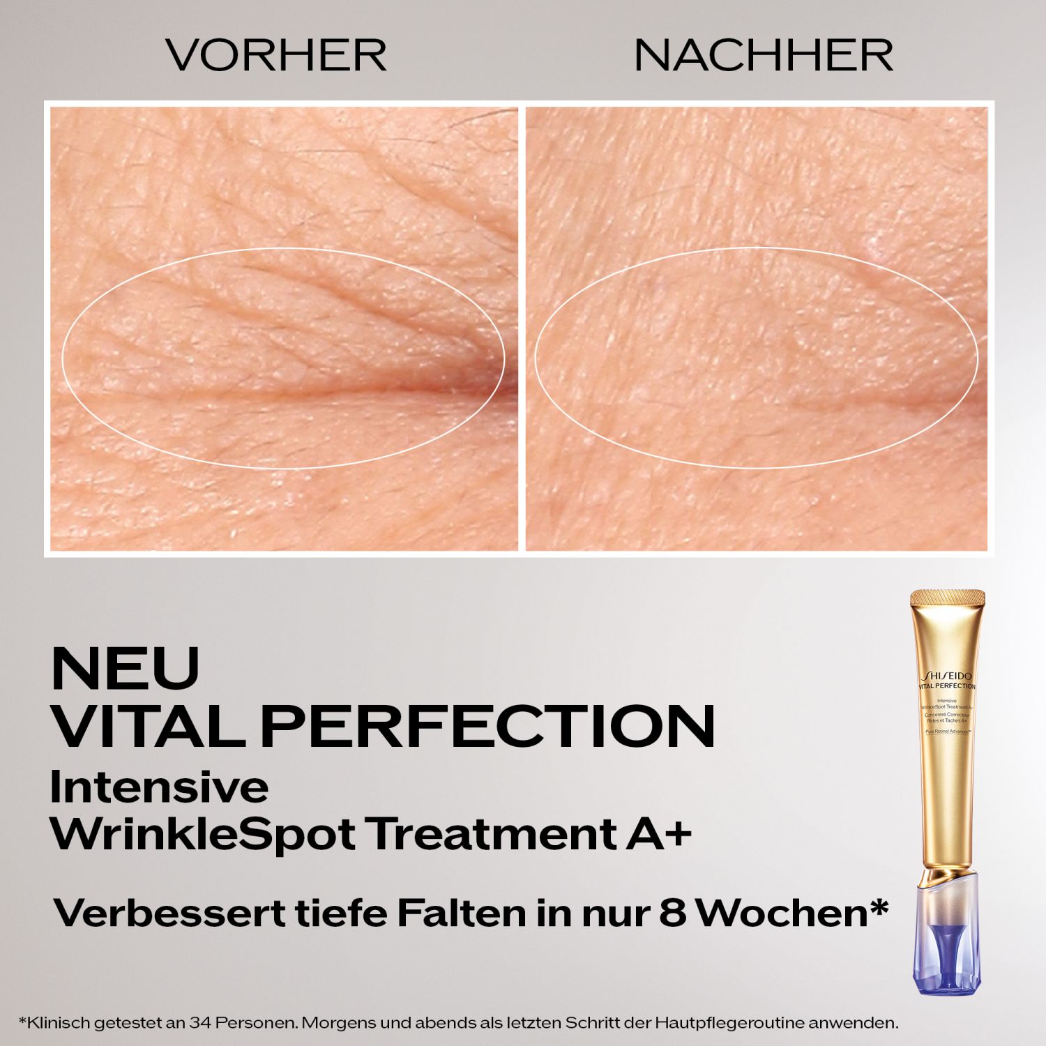 Vital Perfection Intensive WrinkleSpot Treatment A+
